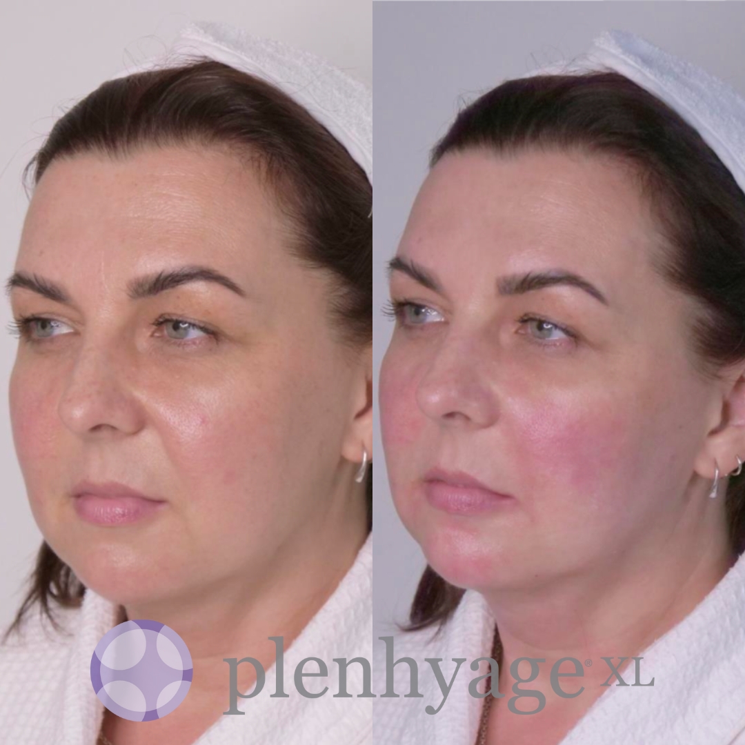 Stymulator tkankowy twarzy oraz szyi