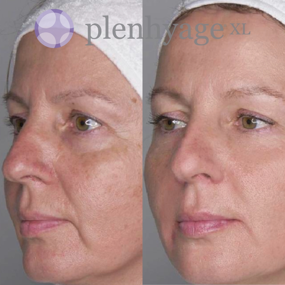 Stymulator tkankowy twarzy oraz szyi