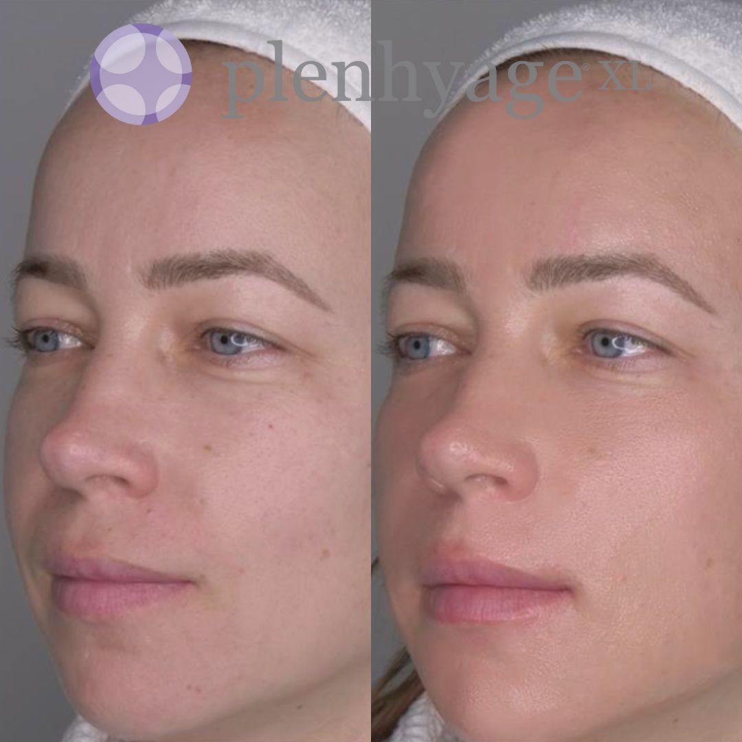 Stymulator tkankowy twarzy oraz szyi