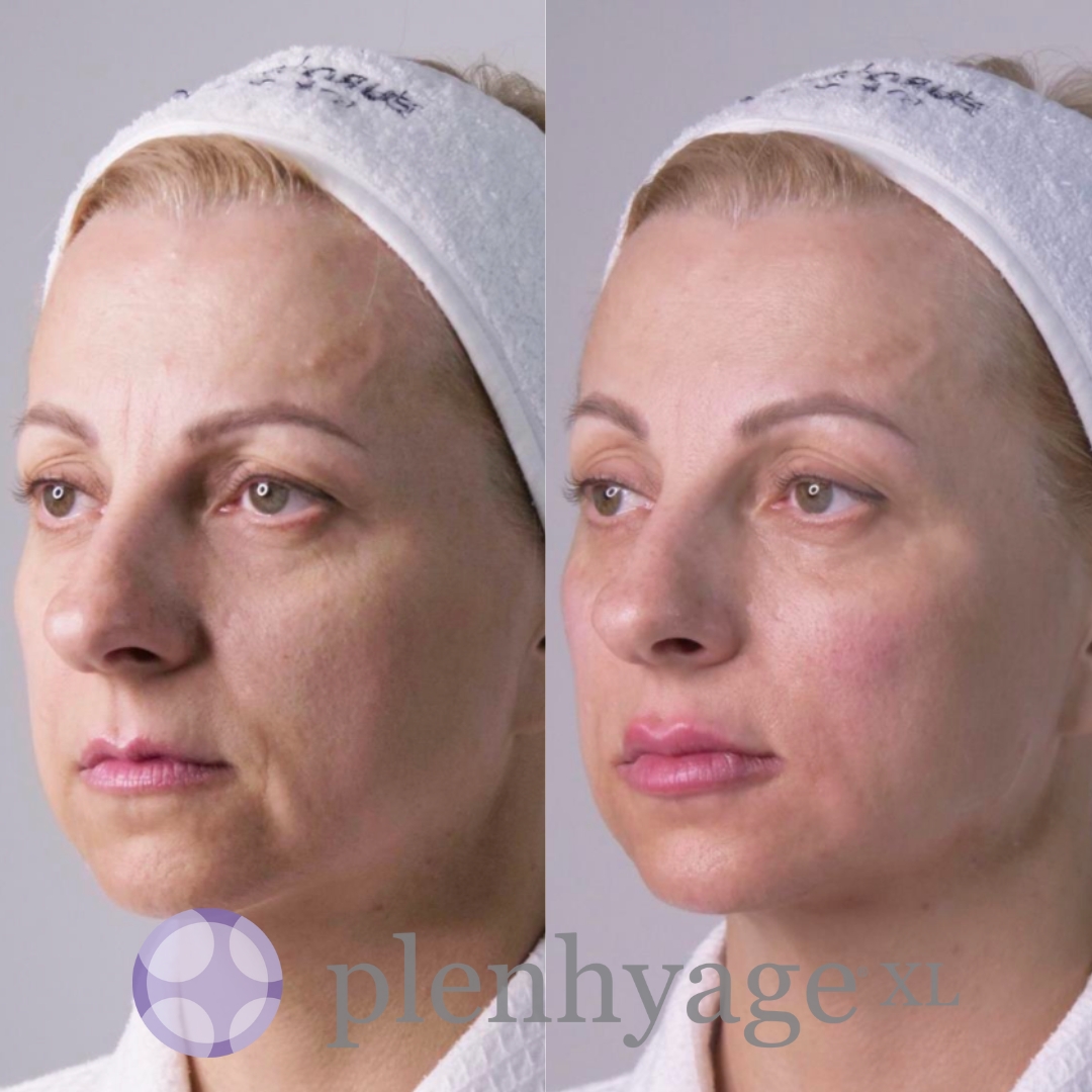 Stymulator tkankowy twarzy oraz szyi